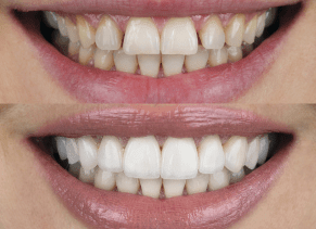 Cosmetic Dentistry